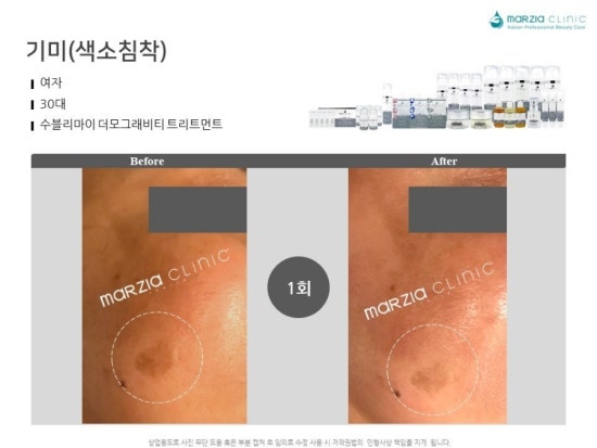 수블리 이미지