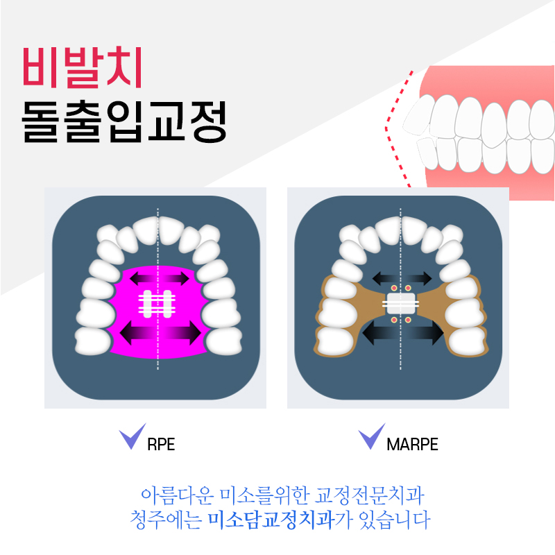 미소담치과 이미지