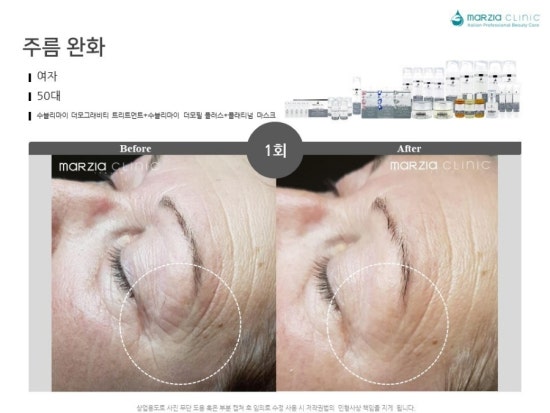 수블리 이미지