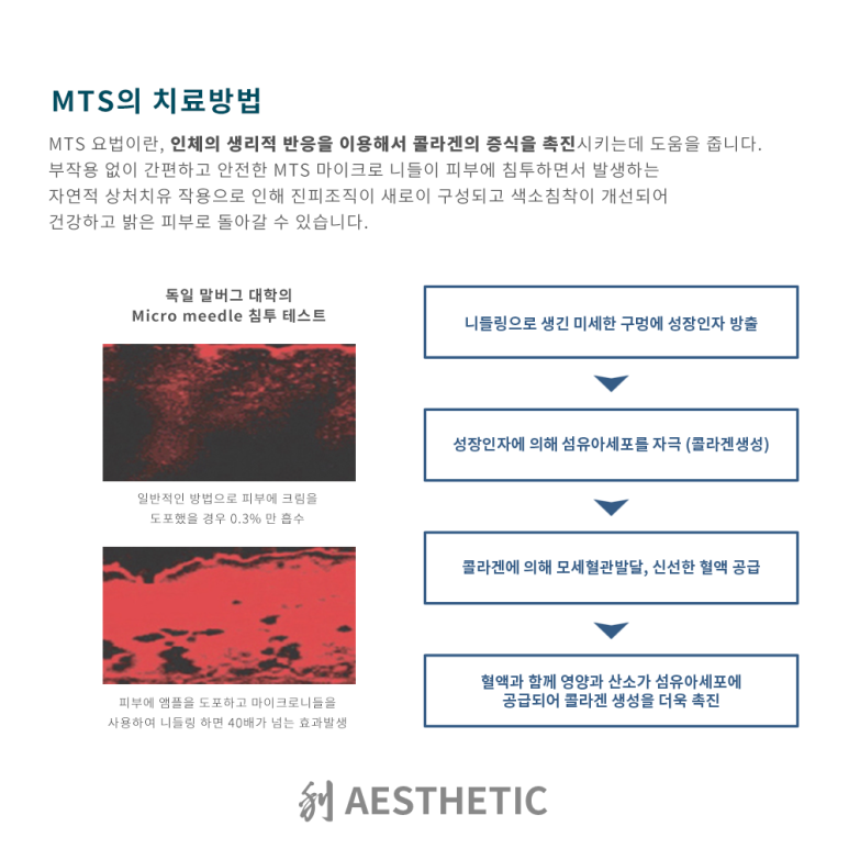리에스테틱 이미지