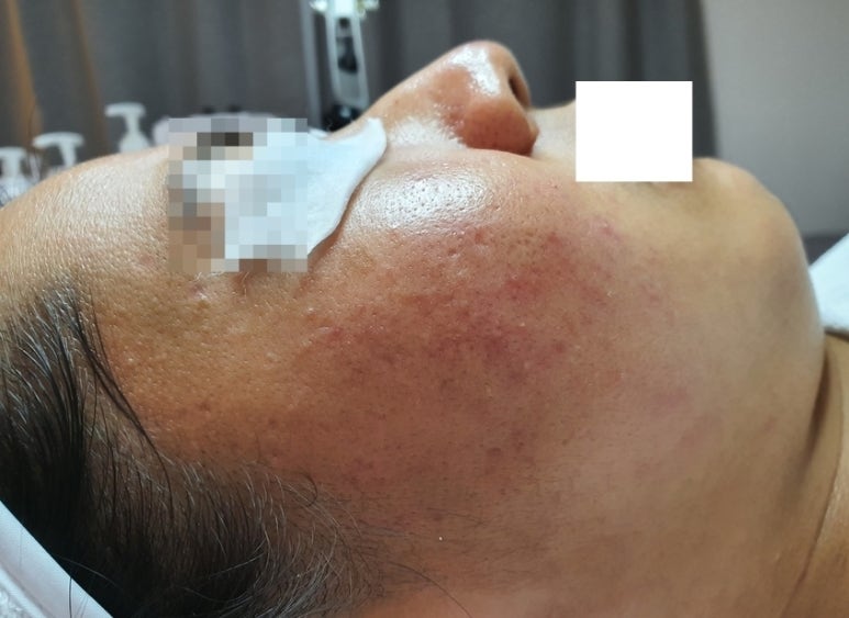 라미아루체 이미지