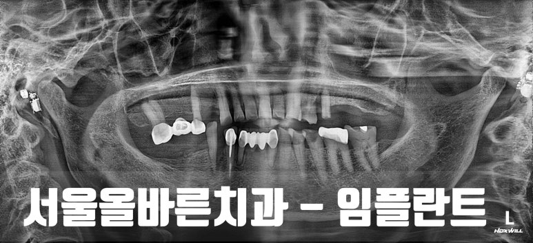 하하하치과의원 이미지