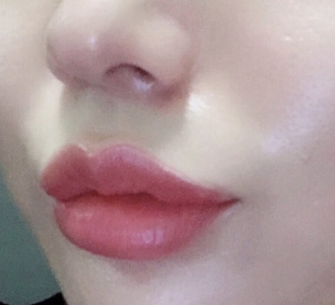 레드성형외과의원 이미지