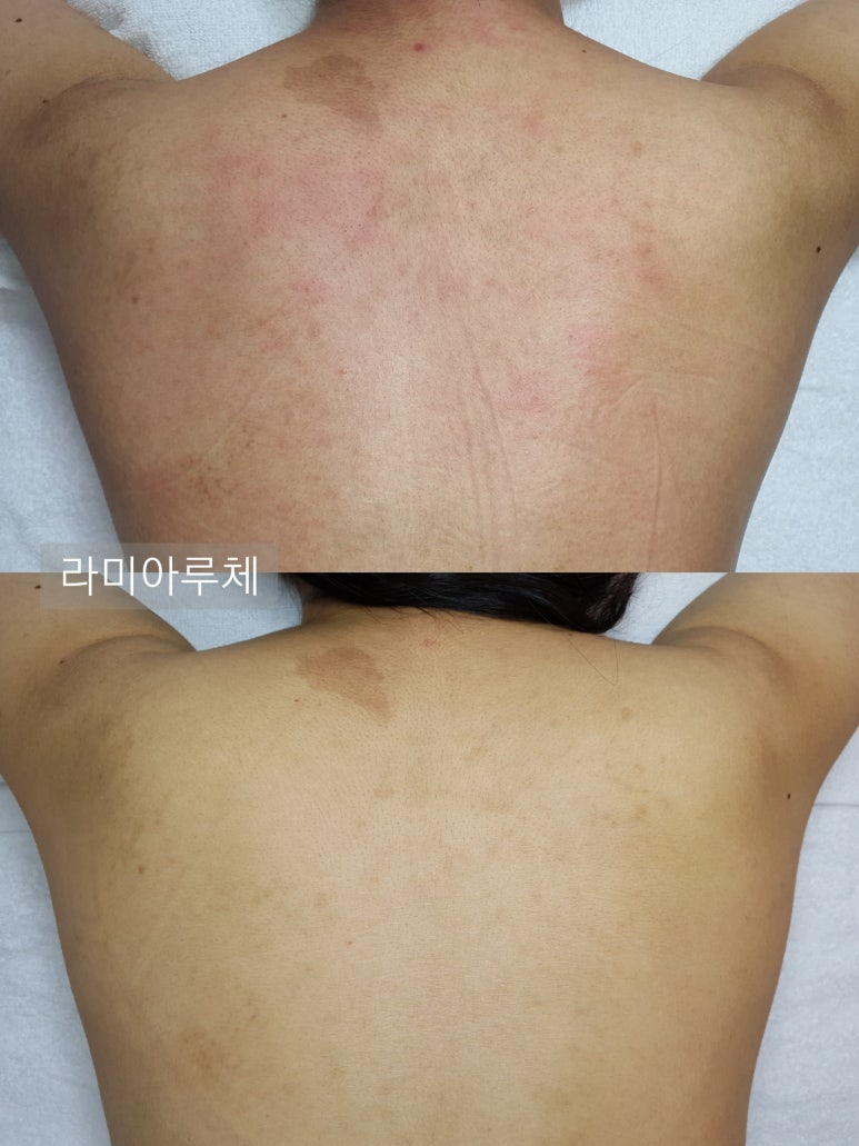라미아루체 이미지
