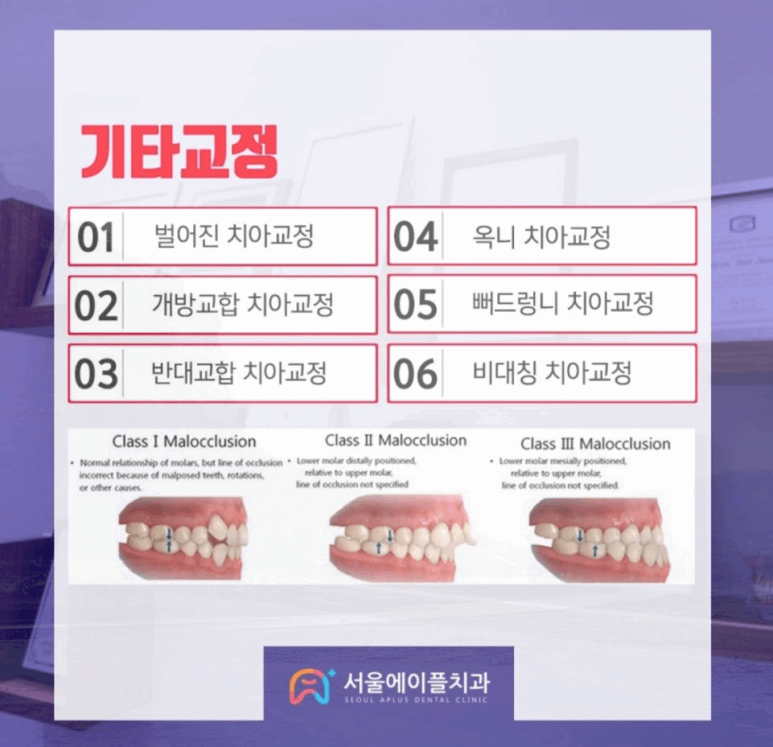 서울에이플치과의원 이미지
