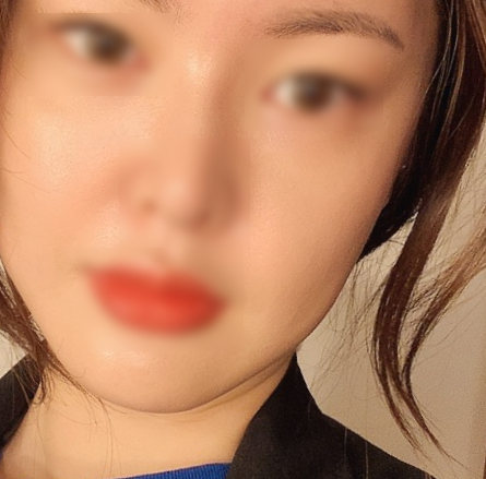 비제이테라피 이미지