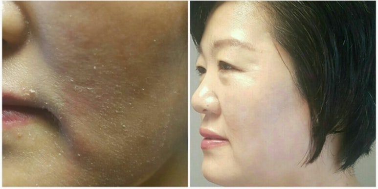 인셀덤경기 이미지