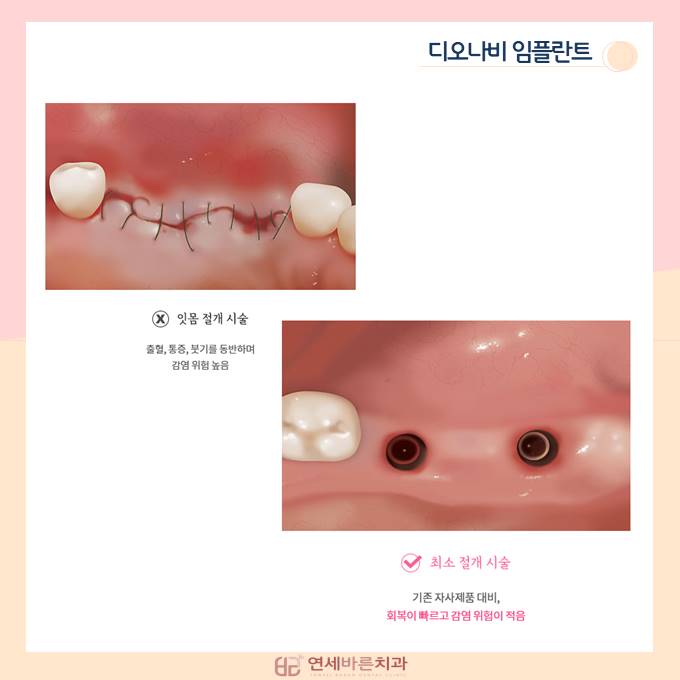 연세바른치과 이미지