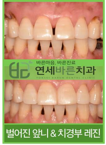 연세바른치과 이미지