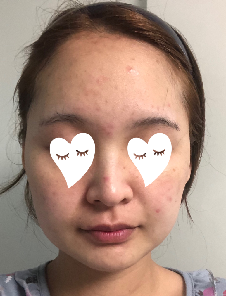 세라핑 이미지