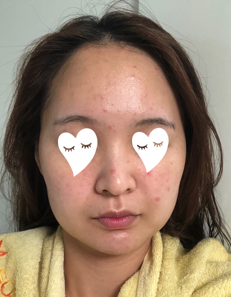세라핑 이미지