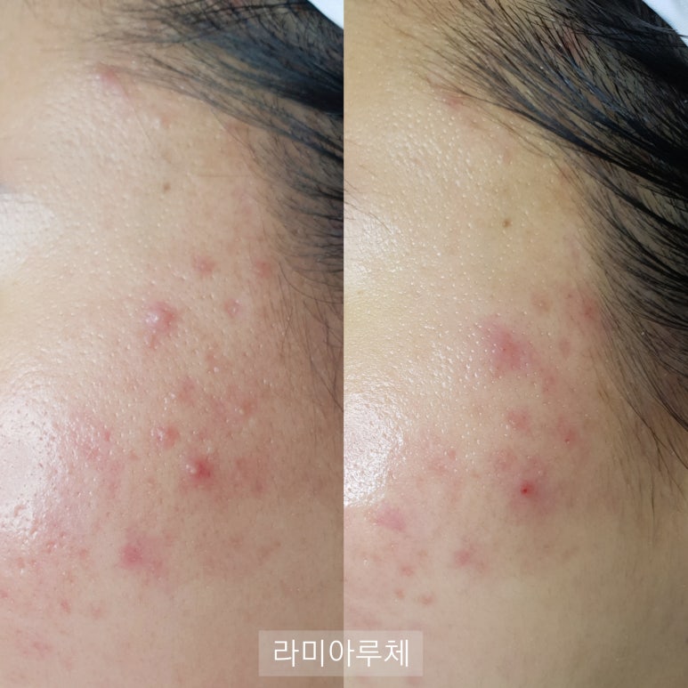 라미아루체 이미지