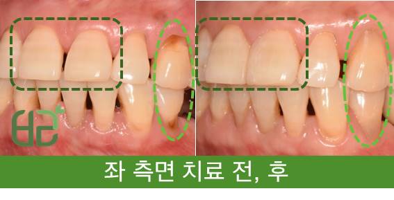 연세바른치과 이미지