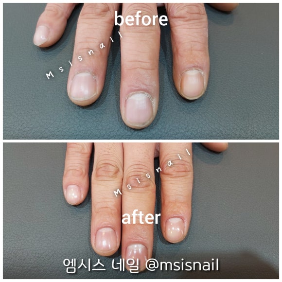 엠시스(MSIS) 네일 이미지