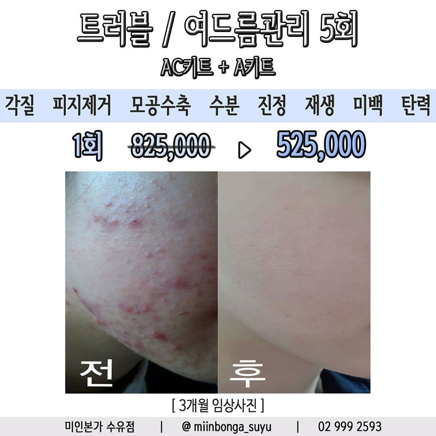 미인본가 이미지
