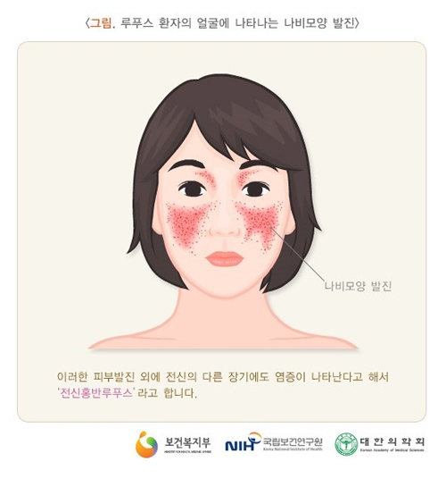 시흥간병인 이미지