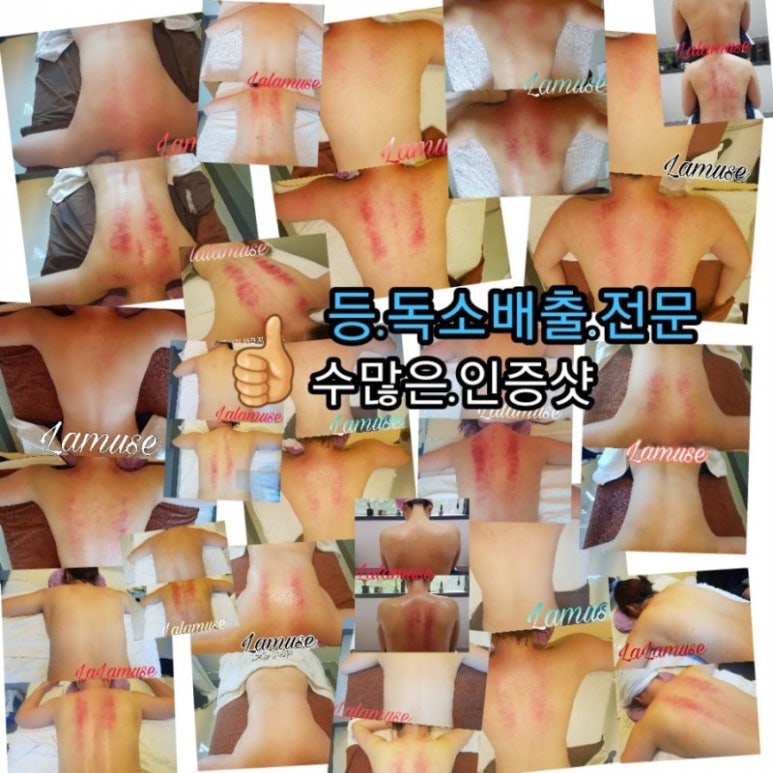라라스킨 이미지