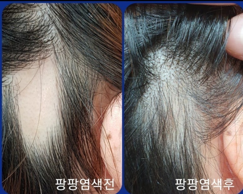 염색팡팡 이미지