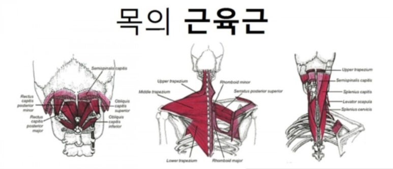 약손통증전문 이미지