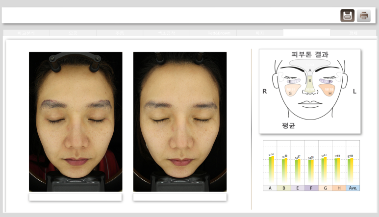 디움의원 이미지