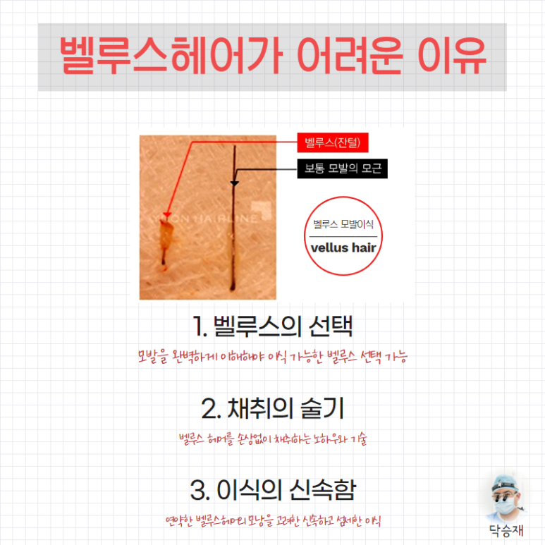 벨루스헤어 이미지