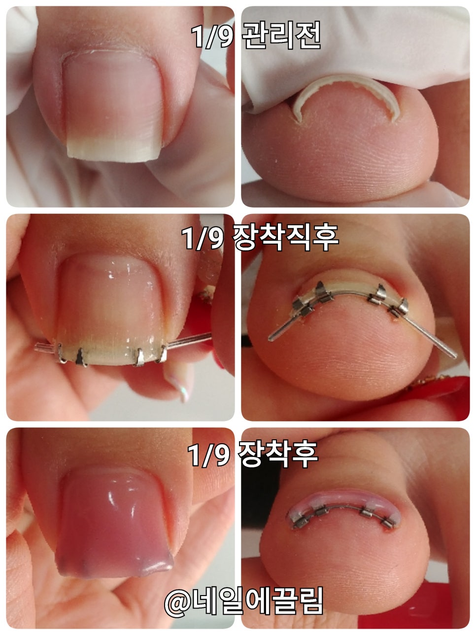 라렌느네일 이미지