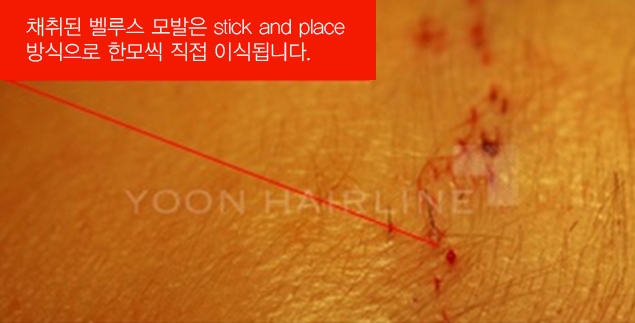 벨루스헤어 이미지