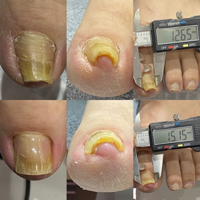 노퐁뷰티 이미지