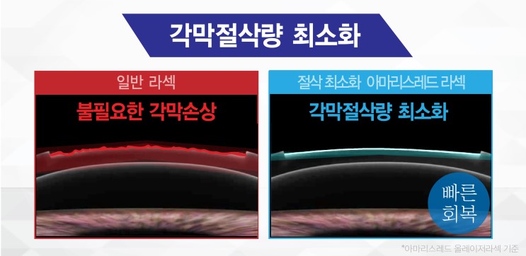 레드김 이미지