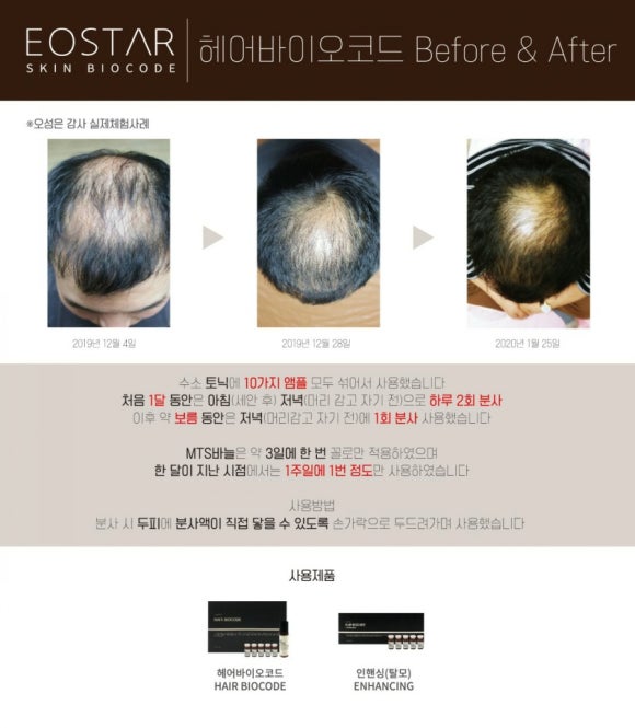 이오스타 이미지