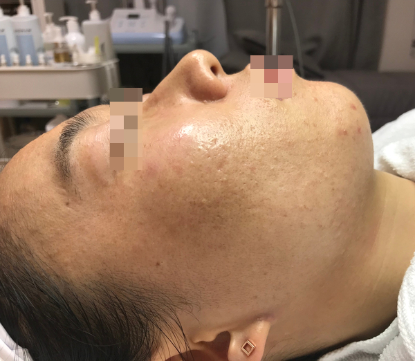 라미아루체 이미지