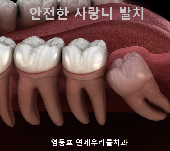 우리치과 이미지