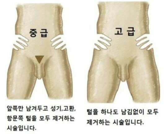 그남자왁싱 이미지