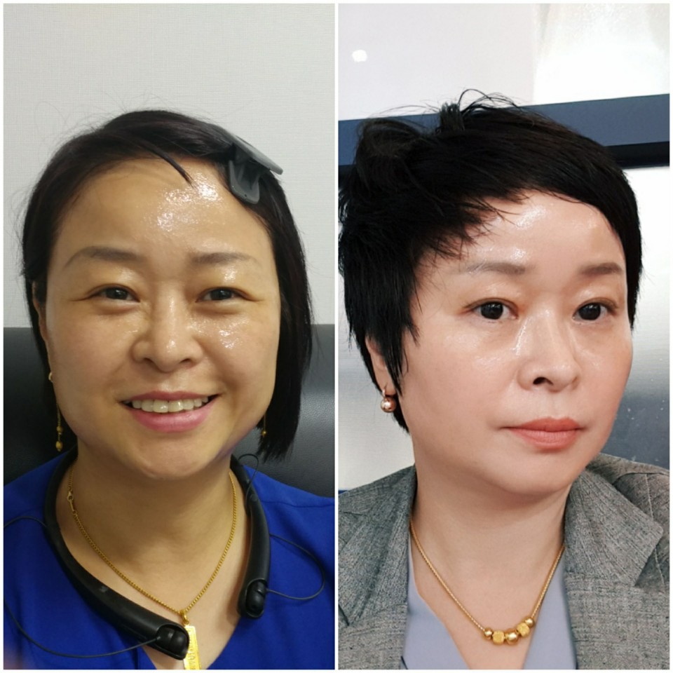 인셀덤잠실 이미지
