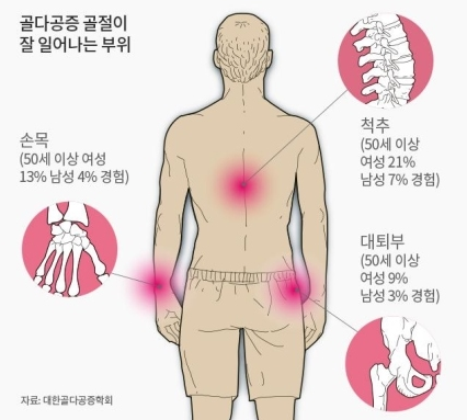 섹칼슘 이미지
