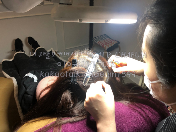 대구가발스칼프채움 이미지