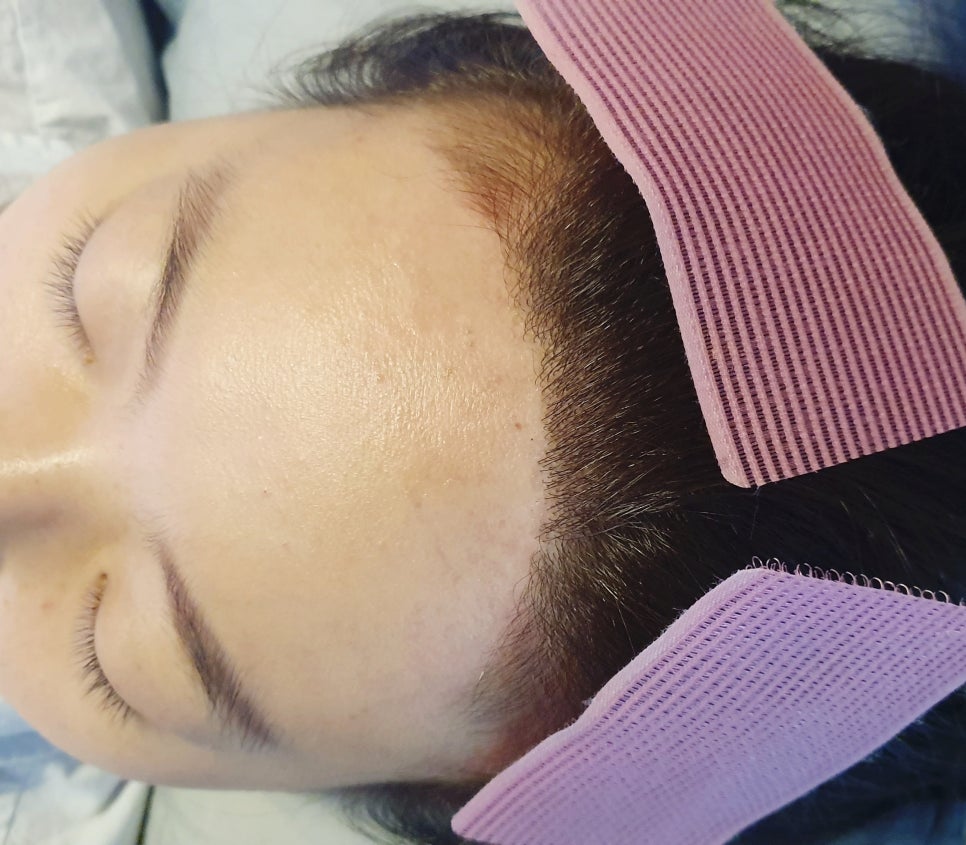 퀸헤어라인 이미지