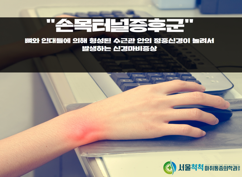 서울척척마취통증의학과 이미지