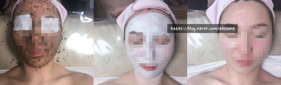 스킨스토리(story) 이미지