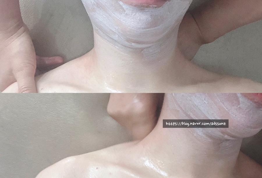 스킨스토리(story) 이미지