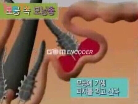 바로바디 이미지