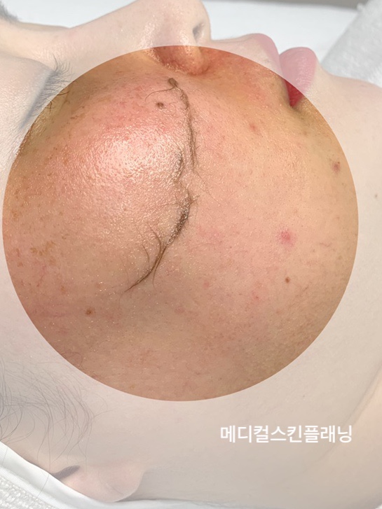 도이네일 이미지