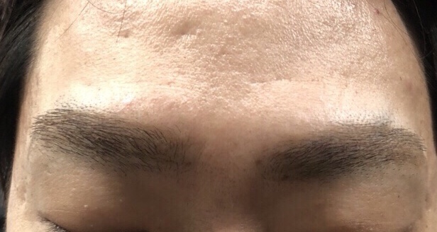 바케네일 이미지
