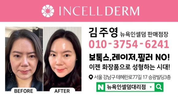 인셀덤하다 이미지