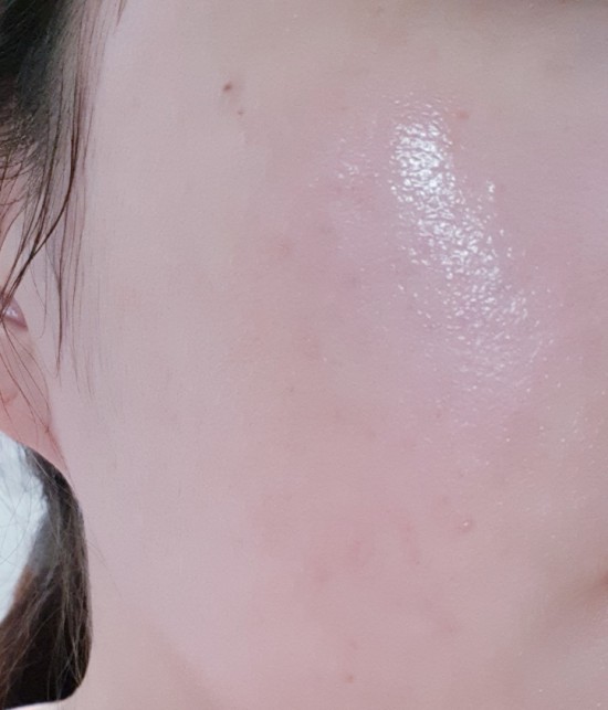 르아밍 이미지