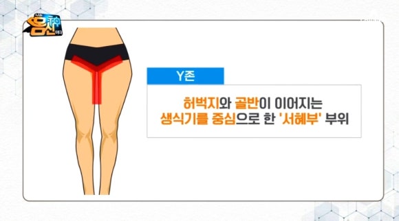 다이어트존 이미지