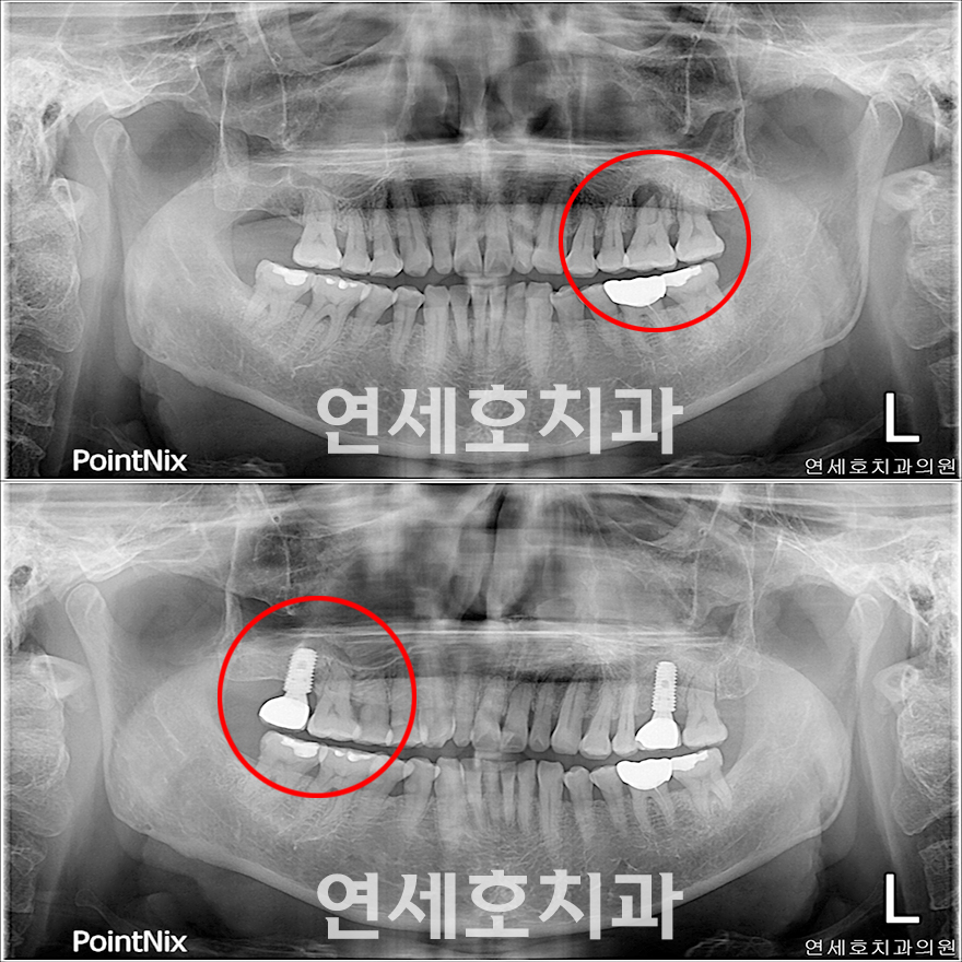 오*재 이미지