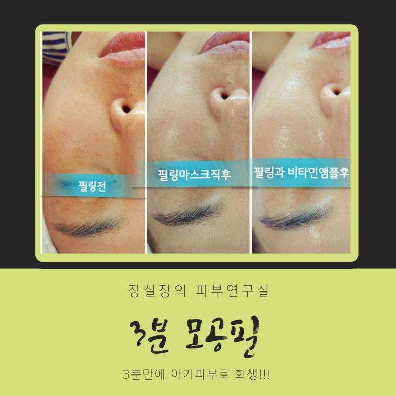 마쏘아로마 이미지