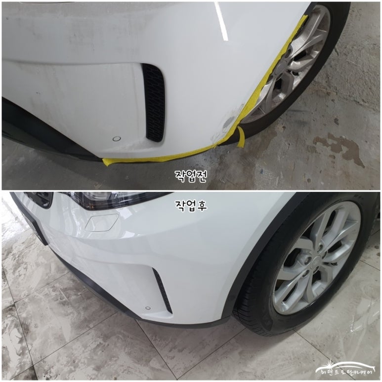 허덴트 이미지