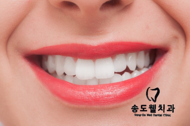 연수웰치과 이미지